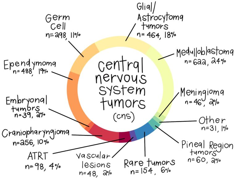 CNS_Tumors_9.8.23